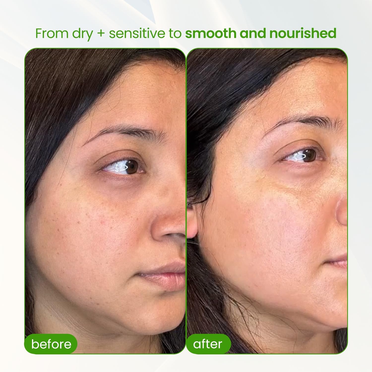 Barrier Repair Organic Face Cream Moisturizer with Ceramides Squalane Centella and Niacinamide, Fragrance Free, Non-Comedogenic, Gentle Soothing Hydration for Dry, Sensitive, Normal Skin, Travel Size